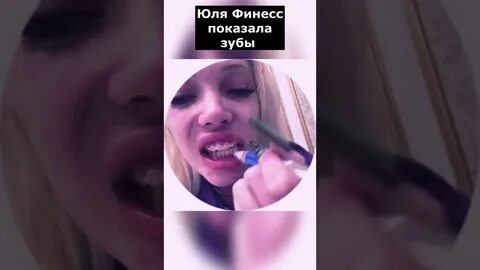 Финесс сейчас