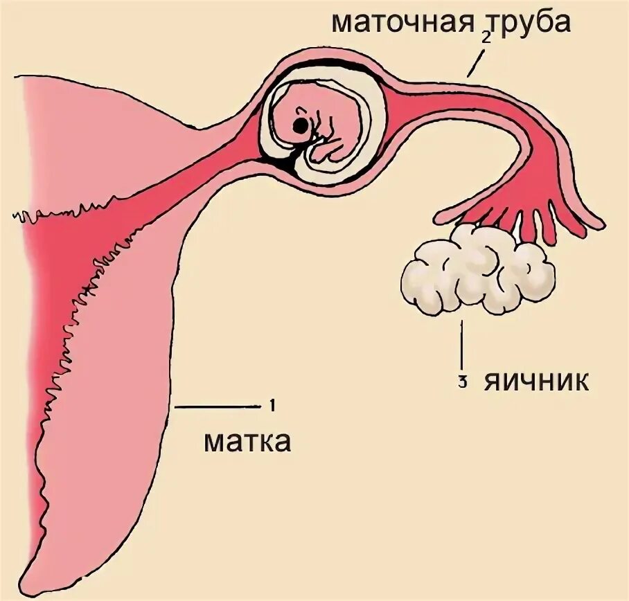 Удаление матки будут ли месячные