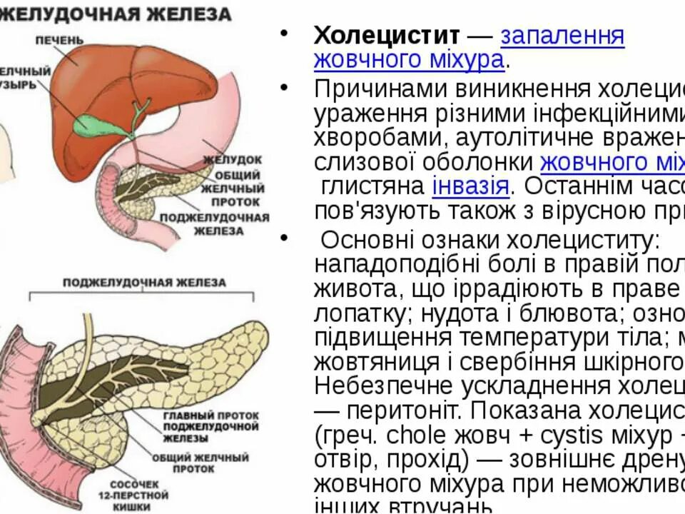 Поджелудочная железа лечение и питание взрослого. Холецистит поджелудочной железы. хронический холецистит и панкреатит. острый холецистит и панкреатит. панкреатит и холецистит поджелудочная.