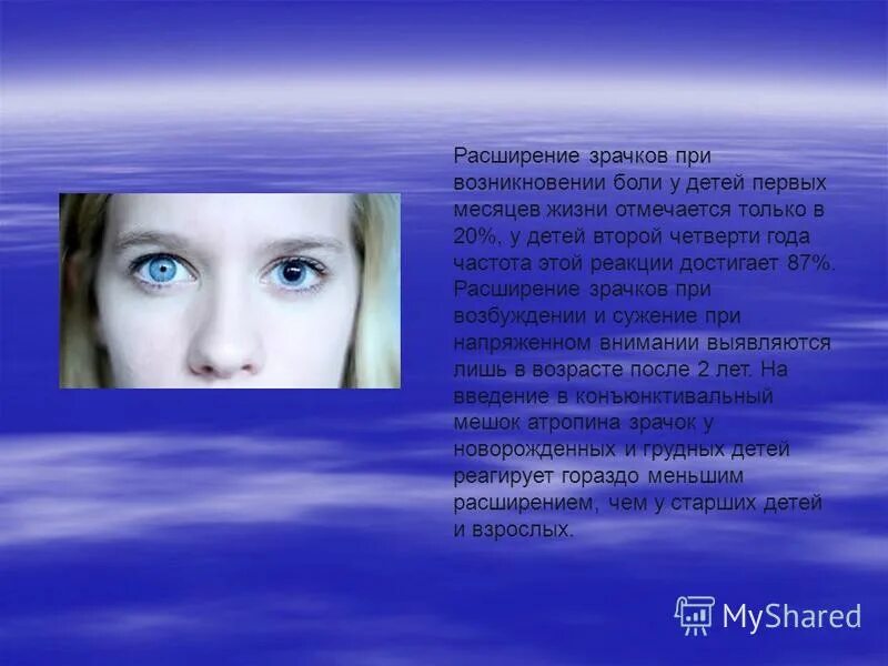 Вижу вспышки света. Глаза с расширенными зрачками. Условно рефлекторная дуга зрачкового рефлекса схема. Зрачок сужается и расширяется. Реакция зрачков на свет.