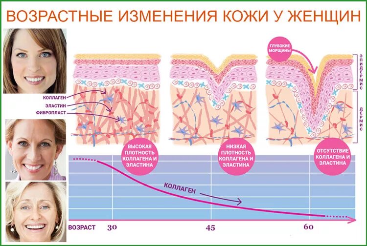 Рф как часто делать. Коллаген эластин фибробласты. Возрастные изменения кожи. Возрастные изменения кожи лица. РФ-лифтинг лица.