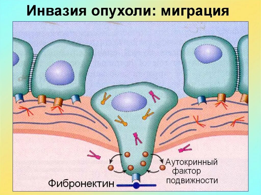 Механизм инвазии опухолевых клеток. Опухоли патофизиология. Опухолевый рост патофизиология.