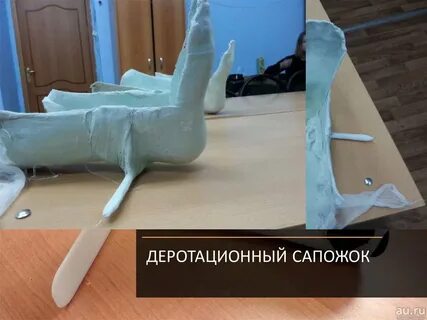 Гипсовый сапожок
