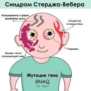 Симптом вебера