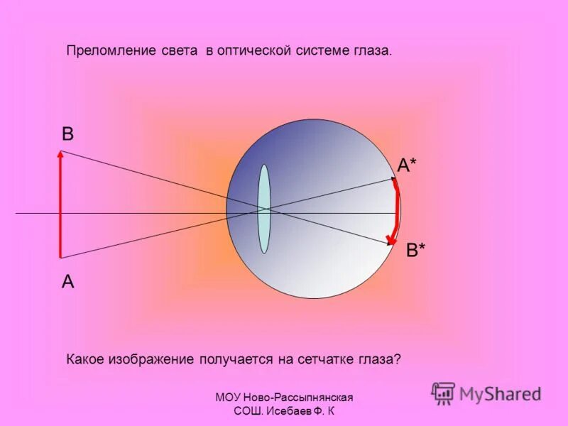 Какое изображение появляется на сетчатке глаза. Преломление света в оптической системе глаза. Изображение на сетчатке глаза получается. Отражение на сетчатке изображение. Преломление лучей света в оптической системе глаза человека.