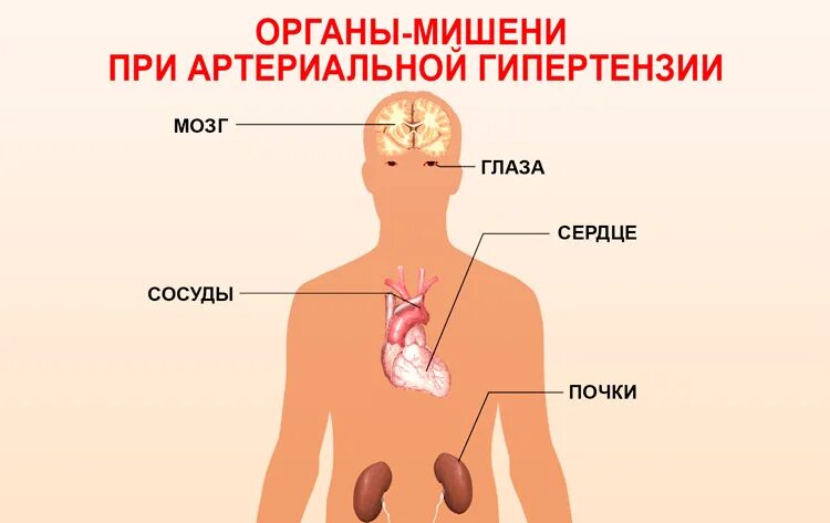 Органы мишени при гипертонической болезни. Органы мишени при артериальной гипертонии. Поражение органов мишеней при артериальной гипертензии. К органам мишеням при артериальной гипертензии относятся.