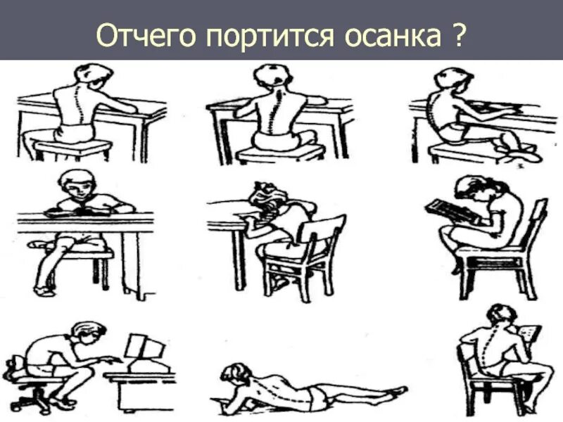 Сгорбленная осанка. Осанка гиперлордоз. Правильная осанка у человека. Портится осанка. От чего портится осанка человека.