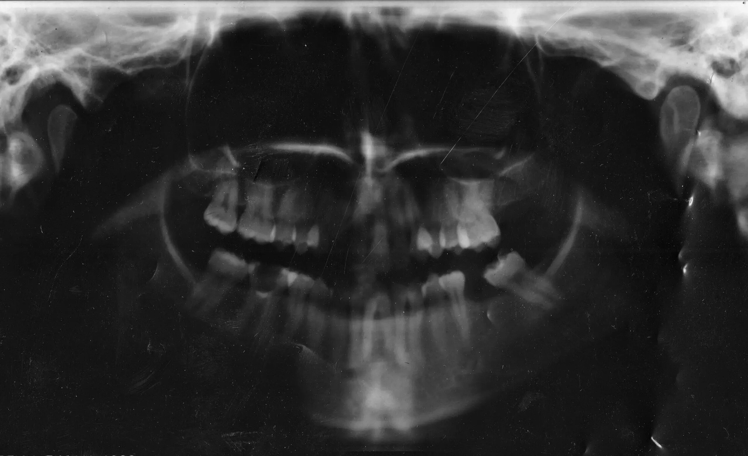 19. 5. Xray texture. 4. Xray texture.