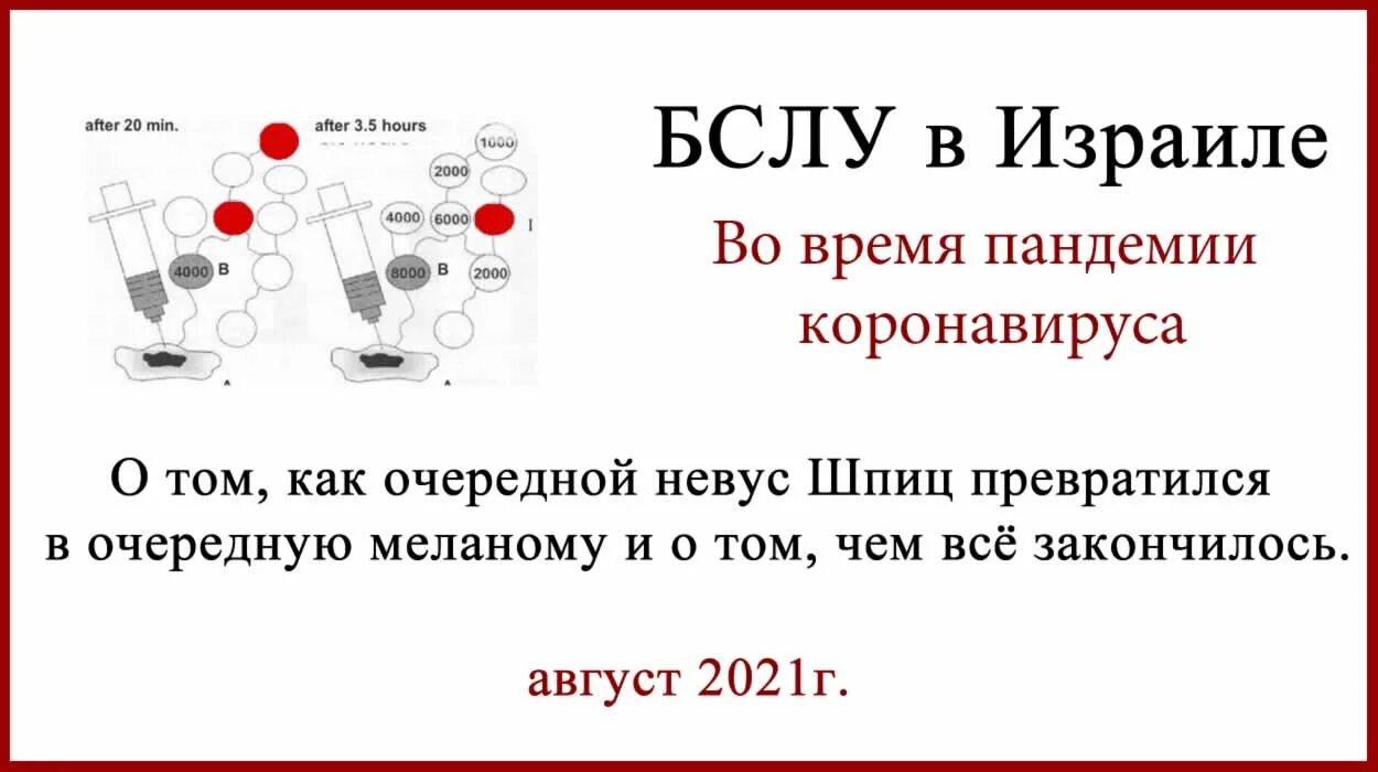 Лечение меланом израиле. Бслу что это такое в медицине. Лечение меланом израиле. Клиника, диагностика, лечение невусов. Мазь для лечения меланомы в таиланде.