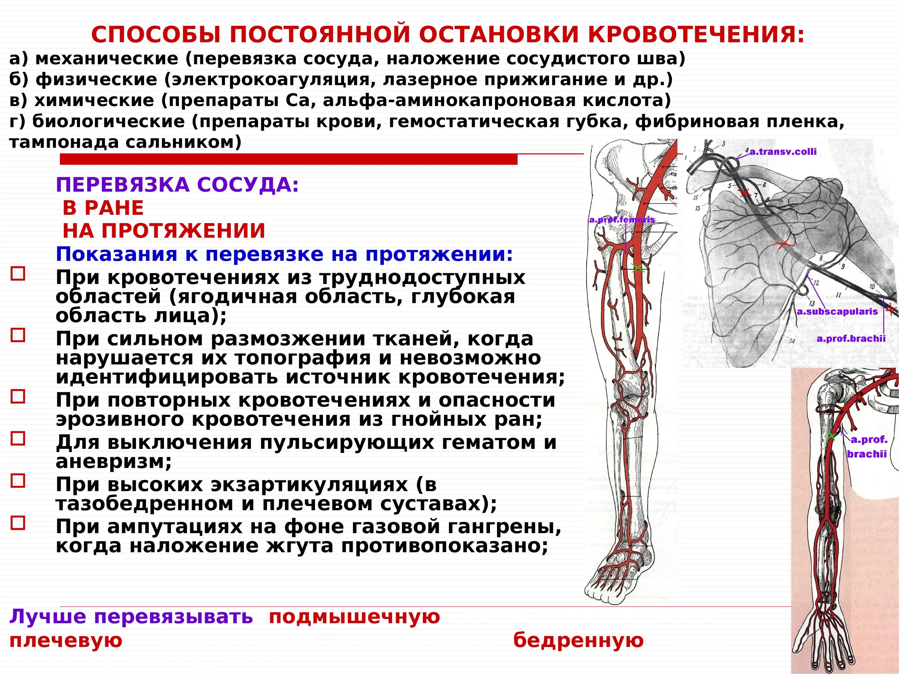 Операции верхних конечностей. Перевязка сосуда на протяжении. Методы остановки кровотечения хирургия. Оперативная хирургия верхней и нижней конечности презентация. Показания к наложению сосудистого шва.