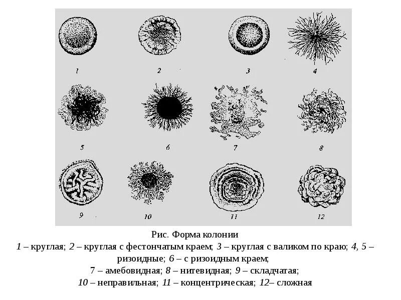 S форма бактерий. Типы колоний микробиология. Формы колоний микроорганизмов. Формы колоний бактерий. S И R формы колоний микроорганизмов.