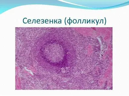 Селезенка гистология презентация