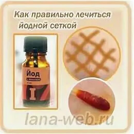 Как работает йодная сетка. Йодовая сеточка для чего. йодная сеточка для чего. йодовая сетка от горла. йодовая сетка при кашле.