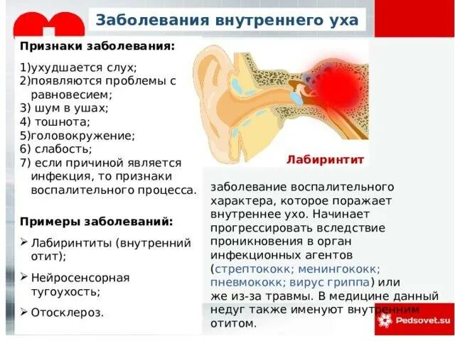 Почему я громко слышу. Внутреннее ухо заболевания. Патология внутреннего уха. Нарушение внутреннего уха симптомы. Заболевания внутреннего уха симптомы.