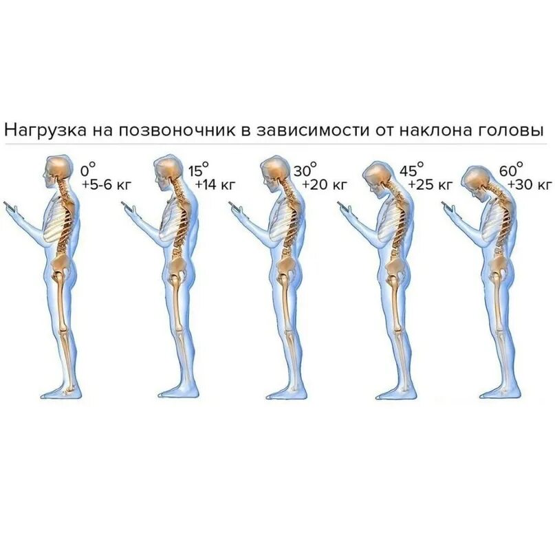 Us medica стул коленный. Плоскостопие и искривление позвоночника. Нагрузка на позвоночник. Нагрузку на ноги позвоночник. Осложнения плоскостопия.