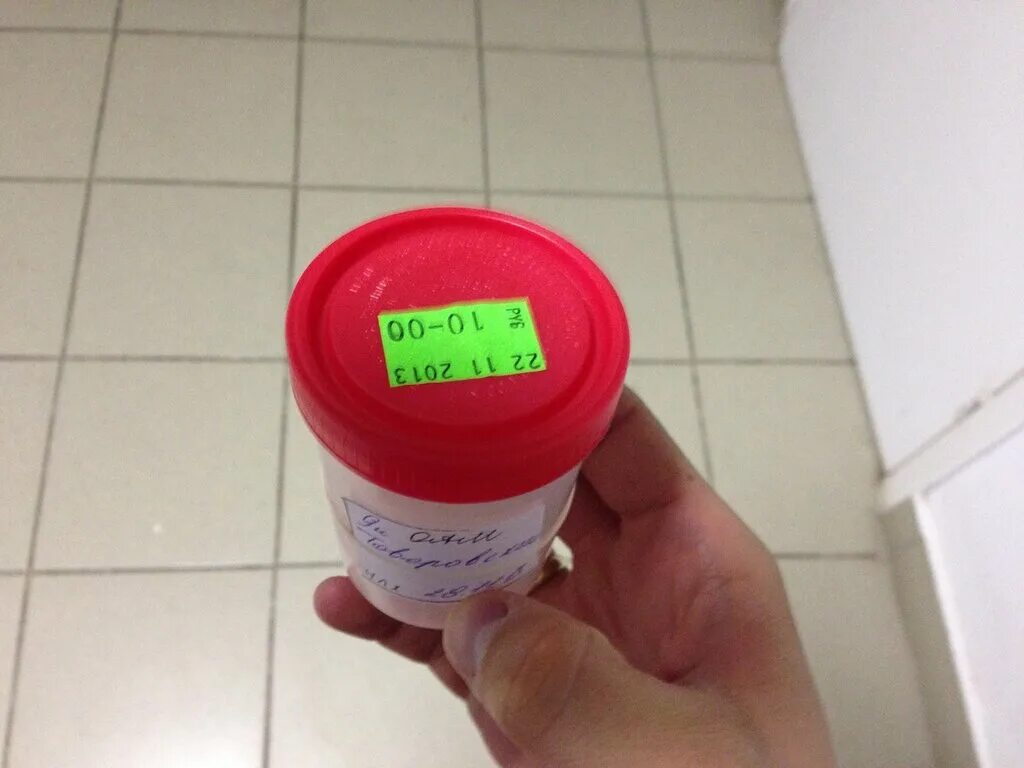 контейнер для сбора биоматериала 120 мл. баночка для спермограммы. баночка с мочой. как подписать баночку для анализов мочи. стаканчик для мочи.