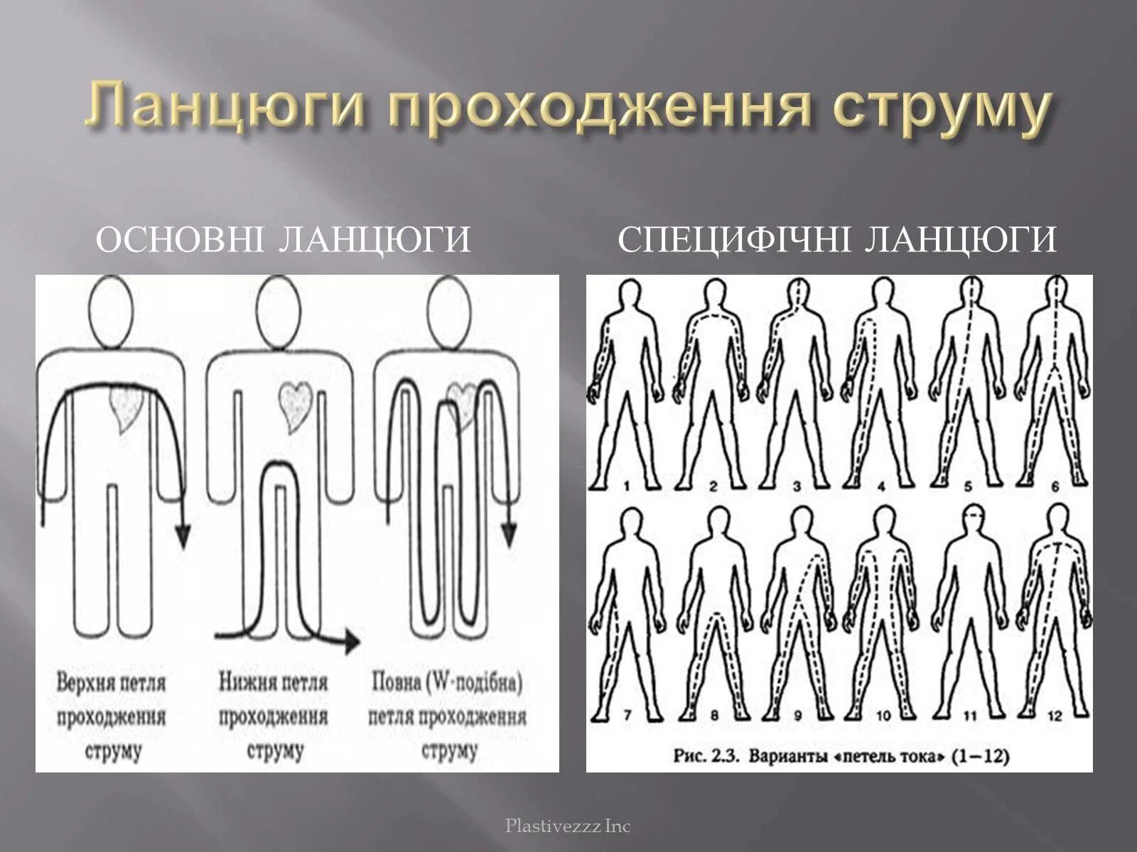 Какие петли тока наиболее опасны. Варианты петель тока. Петля тока через тело человека. Путь («петля») тока через тело человека. Варианты петель тока опасные.