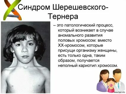 Шерешевского тернера причины
