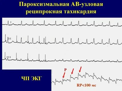 Авурт