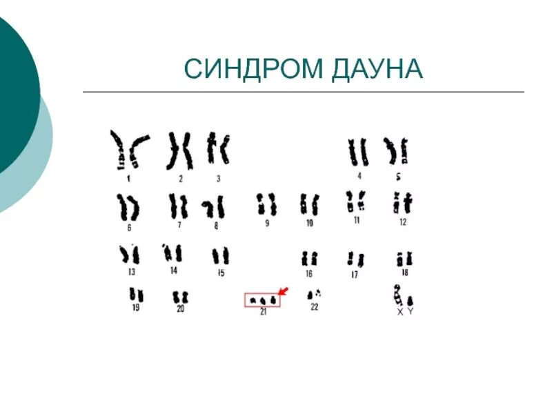 Азбука для даунов. Алфавит для даунов. Русский алфавит для даунов. Форма изменчивости дауна