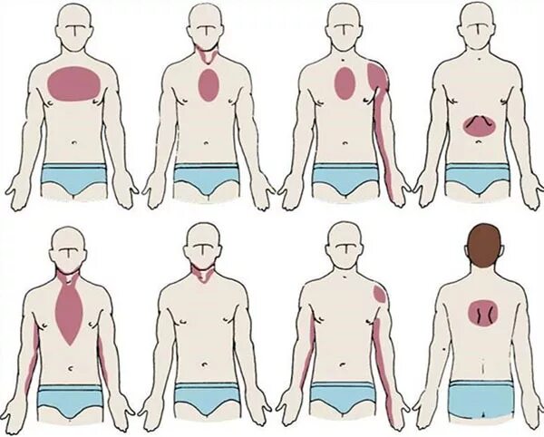 Боли в области сердца у мужчины. Если болит сердце. Локализация боли в сердце. Сердечные боли. Иррадиация боли.