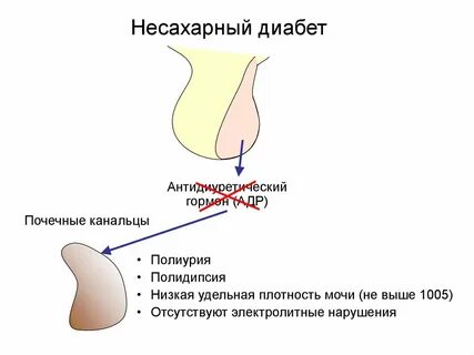 Мочеиспускание при диабете у мужчин