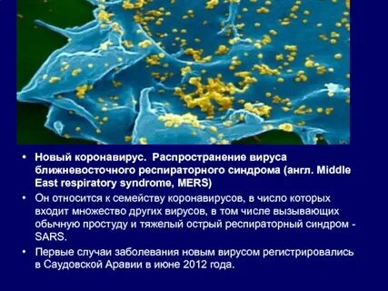 Вирус респираторного синдрома