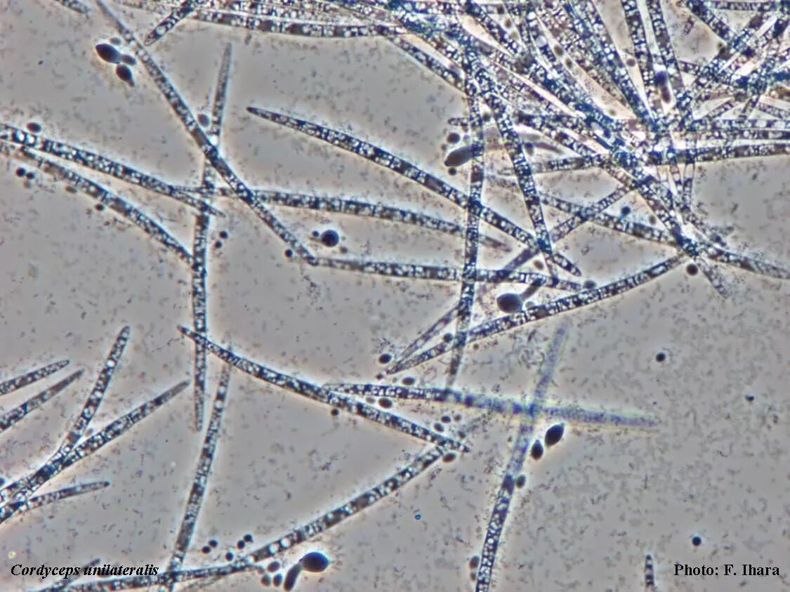 Споры гриба и нити. Мицелий грибов кожи микроскопия. Нити мицелия под микроскопом. Септированный мицелий. Споры мицелий грибка.