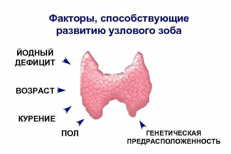 Этиология зоба щитовидной железы. Факторы способствующие развитию заболеваний щитовидной железы. Многоузловой зоб этиология. Узловой зоб этиология. Многоузловой зоб лечение