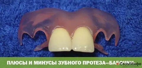 Бабочка на 2 зуба