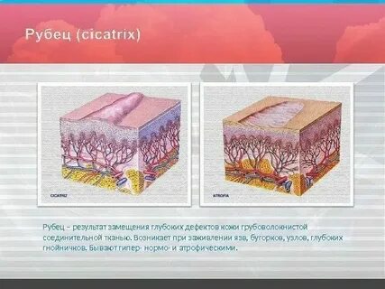 Ткань рубца