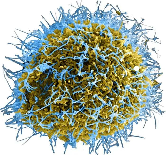 Есть ли у вирусов клетки. Клетка вируса. Вирусы без клетки. Клетка вируса и бактерии. Что внутри вируса.