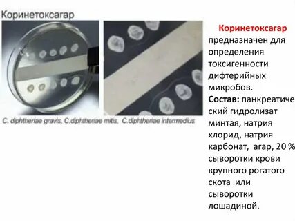 Определение токсигенности дифтерии