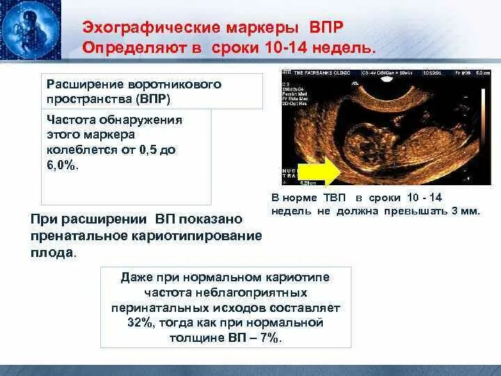 Воротниковая пространство форум. Твп плода. воротниковое пространство. толщина воротникового пространства в 14 недель. расширенное воротниковое пространство.