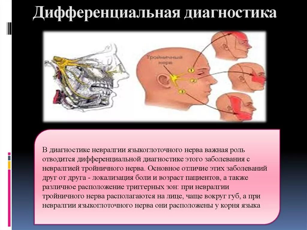 Тройничный нерв тест. Диагностика поражения тройничного нерва. Дифференциальная диагностика невралгии тройничного. Невралгия языкоглоточного нерва диагностика. Невралгия тройничного нерва диагноз.