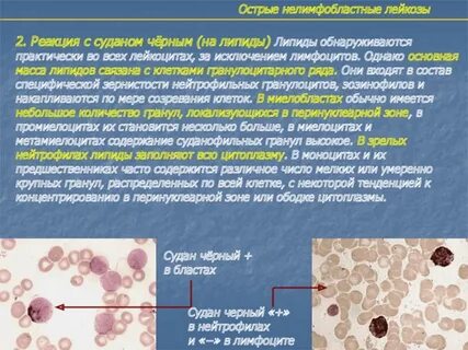 Острые миелоидные лейкозы по утвержденным клиническим