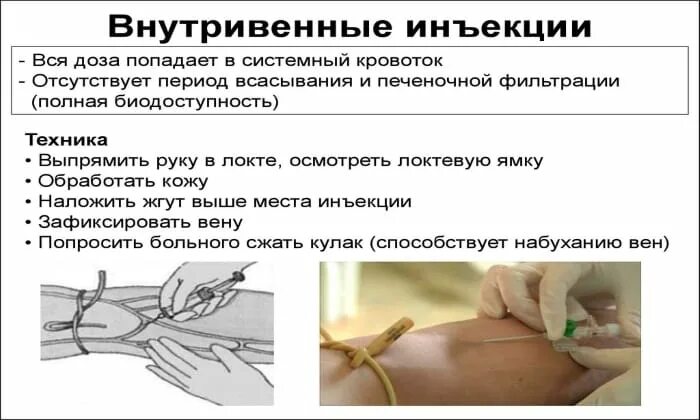 Сколько мл можно вводить внутривенно. Алгоритм проведения внутривенной инъекции. внутривенная инъекция алгоритм. алгоритм внутривенной инъекции инъекции. техника введения вв инъекции алгоритм.
