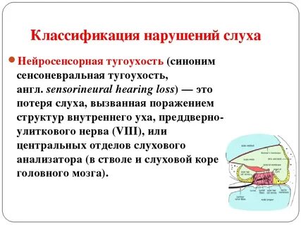 Что такое нейросенсорная потеря слуха