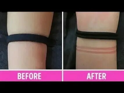 Резинка для волос на руке. Что обозначает все резинки на руке. Что обозначает все резинки на руке. Резинка от девушки на руку. Что обозначает все резинки на руке.