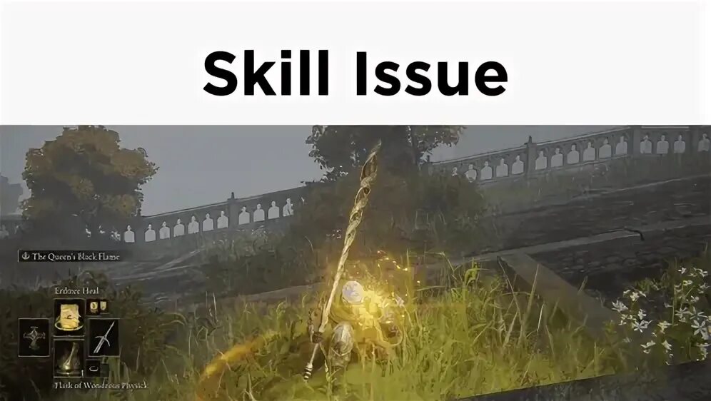 Skill issue
