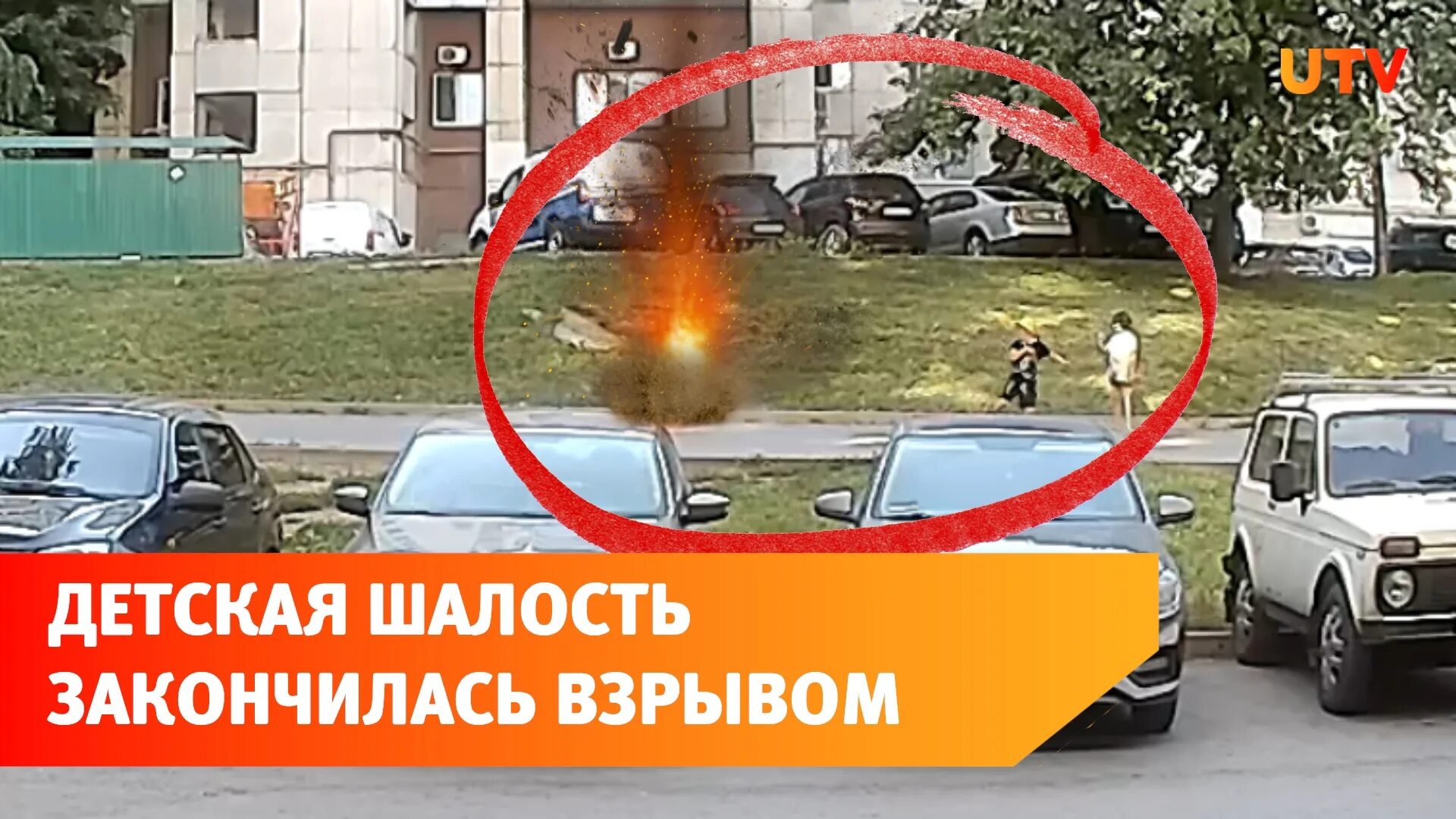 Лицо мальчика после взрыва кеги. Лицо мальчика после взрыва кеги
