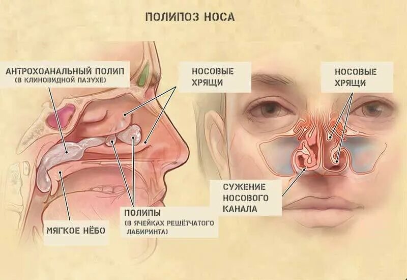 Заложенность носа и 5. Строение носа и пазух в картинках. Носовые пазухи строение.