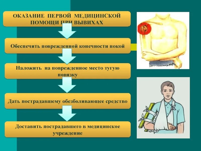 Первая помощь при вывихе 8 класс. Алгоритм действий при оказании первой помощи при вывихе. алгоритм оказания доврачебной помощи при вывихе. последовательность оказания первой медицинской помощи при вывихах. алгоритм оказания 1 доврачебной помощи при вывихе.