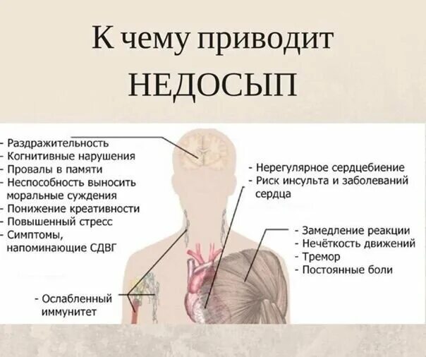 Умирали ли от недосыпа. Последствия недосыпания. Недосыпание симптомы. Признаки недосыпа. Хронический недосып симптомы.