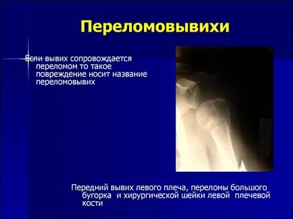 Вывих клинические рекомендации