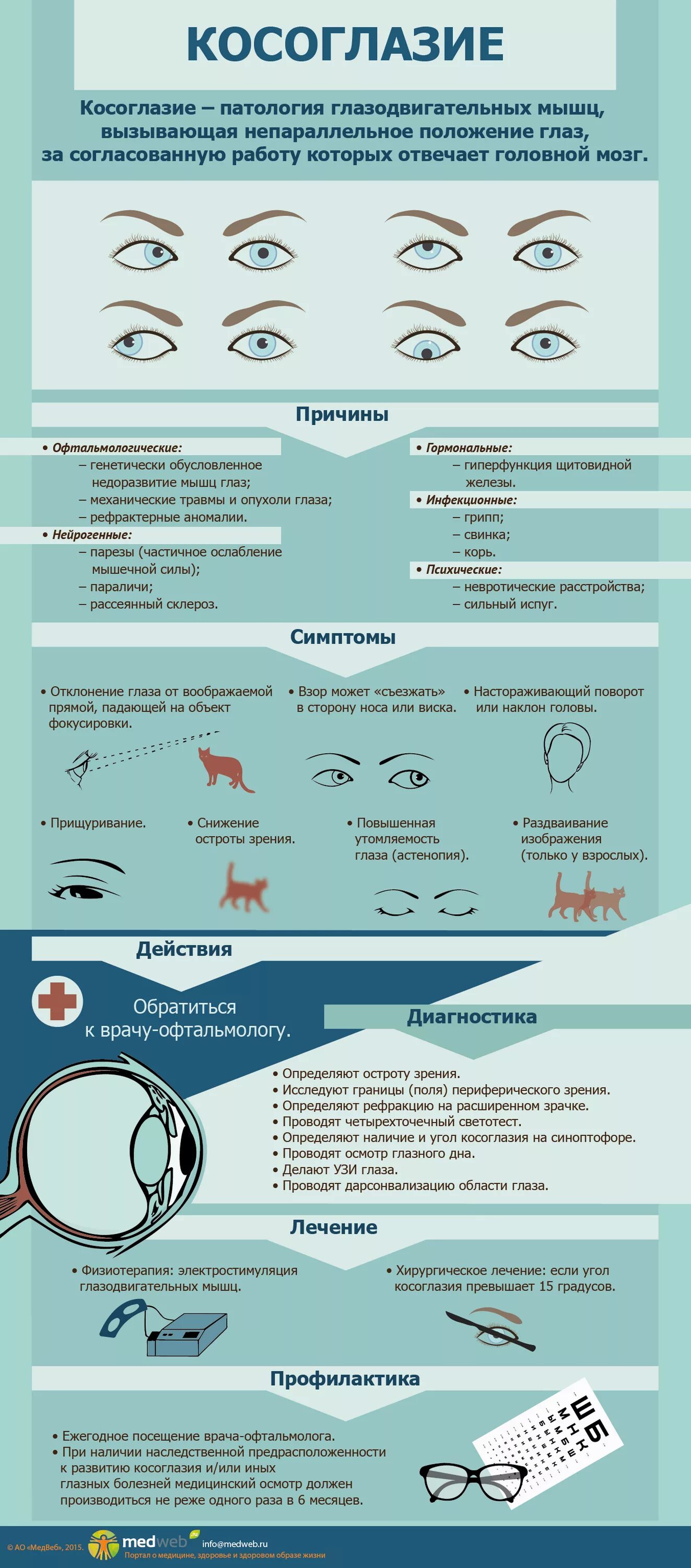 Таблица заболевания глаз косоглазие. Косоглазие причины возникновения. Инфографика заболевания глаз. Профилактика косоглазия. Косоглазие симптомы