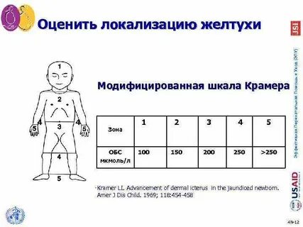 Показатели желтухи у новорожденных