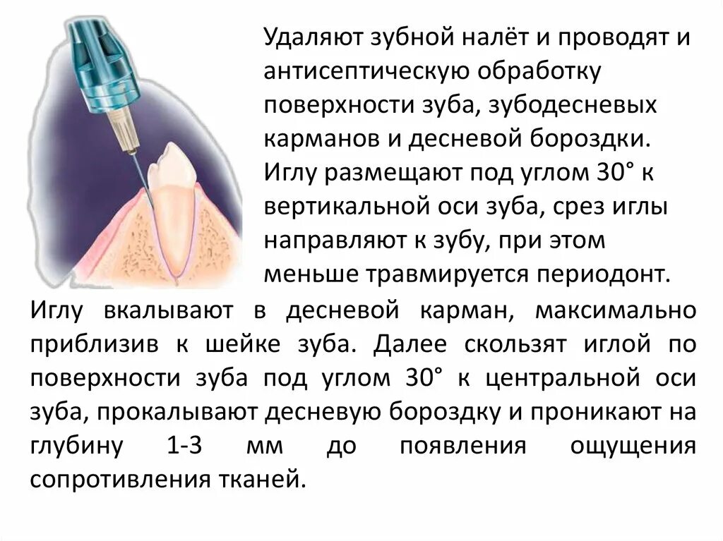 Местная анестезия в стоматологии. Местная анестезия при удалении зуба. Анестезия в десневой сосочек. Местной анестезией ампутация.