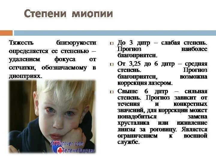 Степени миопии. Миопия слабой степени что это у ребенка. миопия 1 степени что это у ребенка. миопия средней степени. близорукость слабой степени.