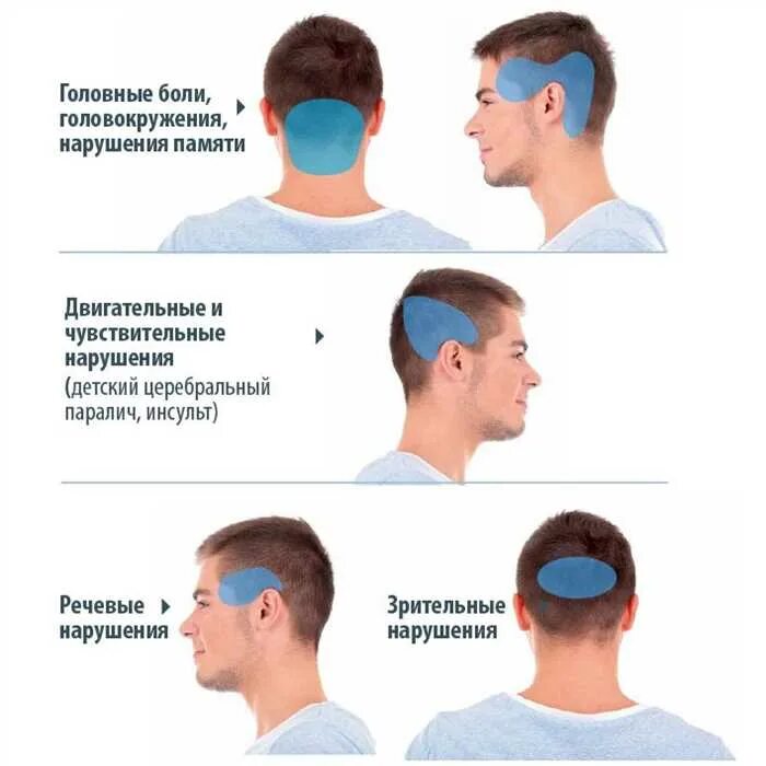 Головная боль подергивание мышц. Головная боль локализация. головная боль лоб и затылок.